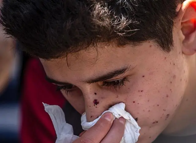طفل جريح، نجل عبد الله أبو كلوب، يبكي قرب جثماني والده في مستشفى الشفاء بمدينة غزة، بقطاع غزة، 4 يونيو/حزيران 2026، حيث قُتل في غارة أودت بحياة تسعة فلسطينيين على الأقل، بينهم نساء وأطفال.